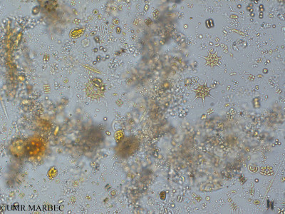 phyto/Pertuis Charentais/Tasdon_st2/PAMPAS 2019-2021/Tetrastrum sp (TASDON_St2_R1_0719034).tif(copy)_thumb.jpg